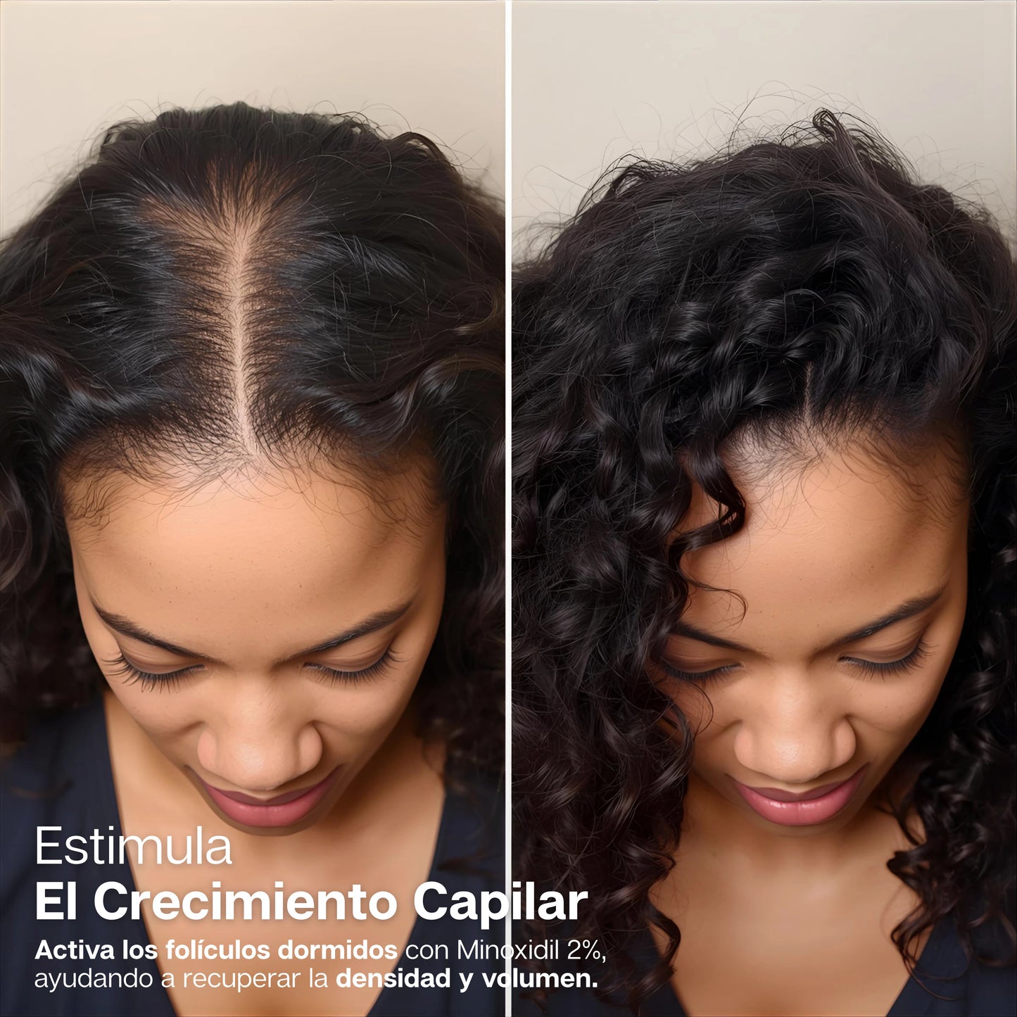 Capiliss | Formula Minoxidil 2% + Biotina Para Mujer