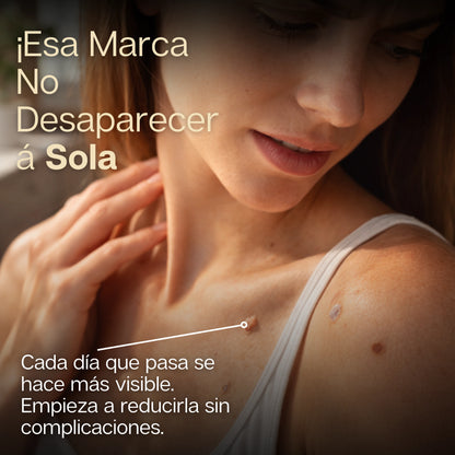 SkinReset | Tratamiento Intensivo para Verrugas y Manchas