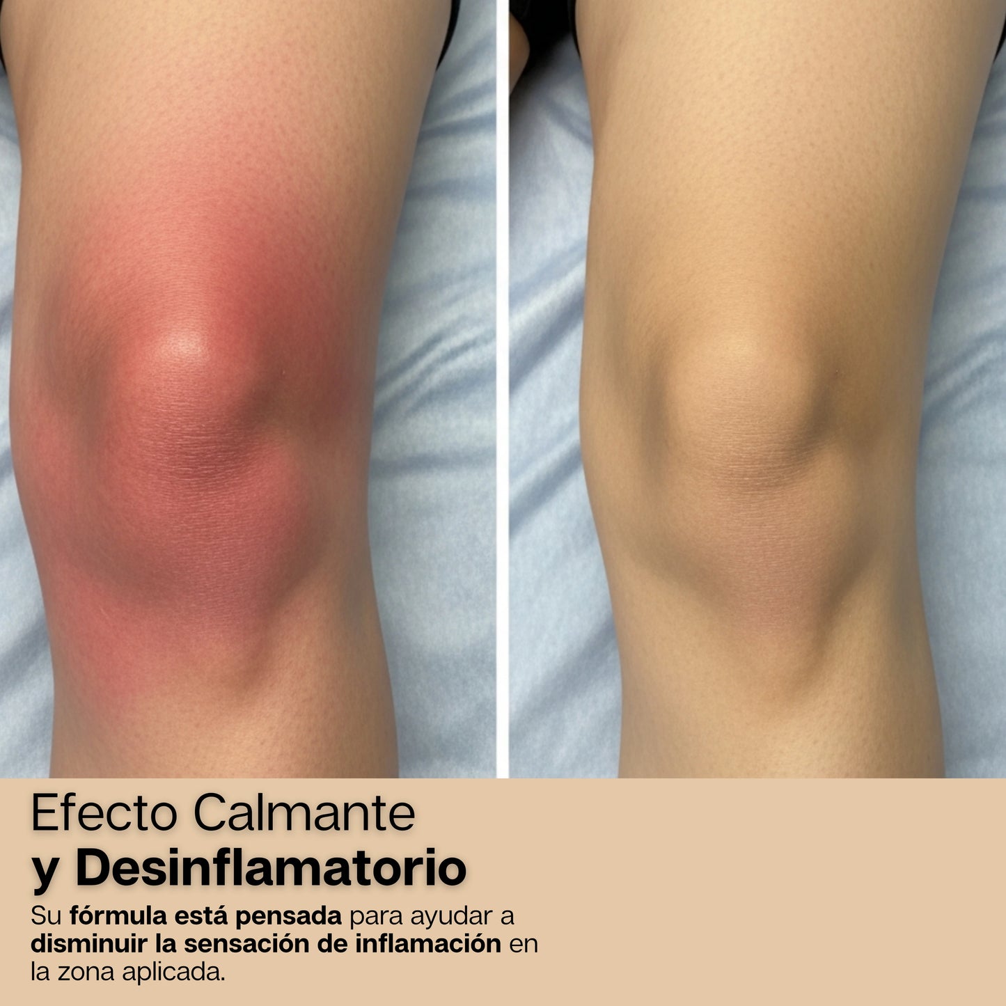 BeeEase | Crema 100% Natural Para Dolores Y Desinflamación de Articulaciones