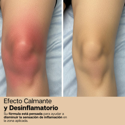 BeeEase | Crema 100% Natural Para Dolores Y Desinflamación de Articulaciones