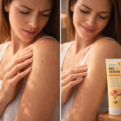 SkinReset | Tratamiento Intensivo para Verrugas y Manchas
