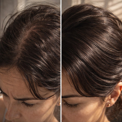 HairBloom | Reparador Capilar Profesional Anticaída con Extracto de Romero.