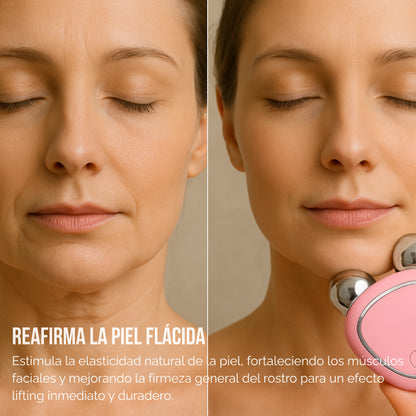 Sculpty | Masajeador Facial Rejuvenecedor
