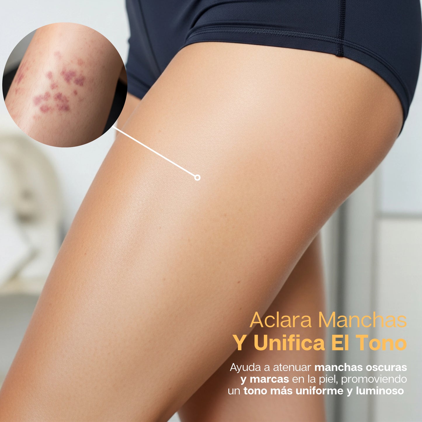 BeeDerm | Crema 100% Natural Removedora de Verrugas, Lunares y Cicatrices